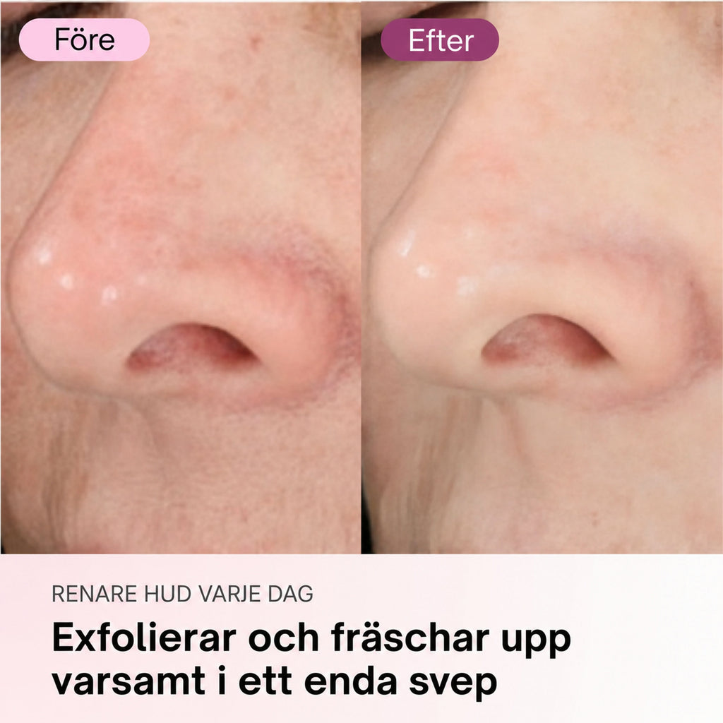 Zero Pore-pads