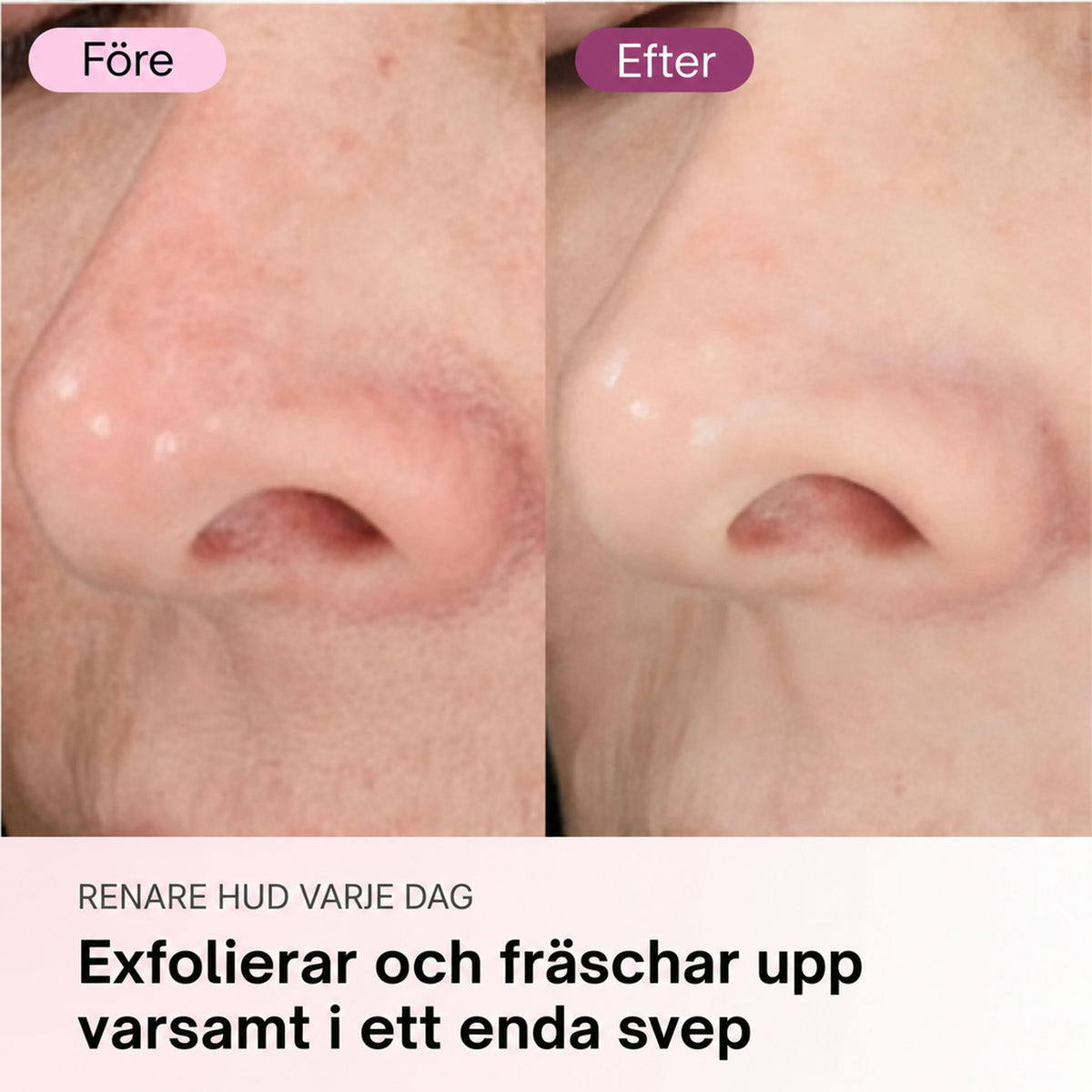 Zero Pore-pads