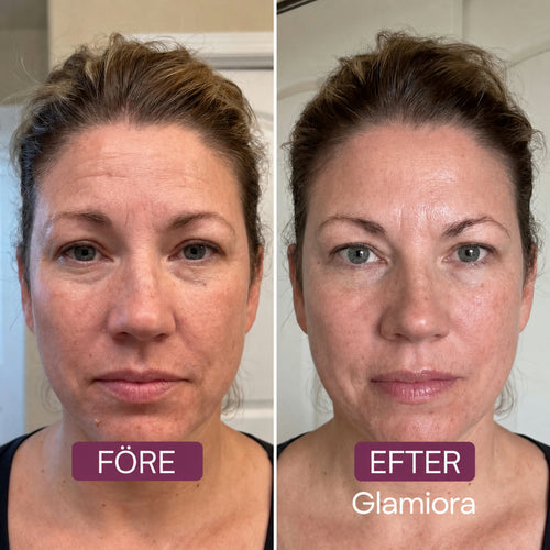 Anti-aging-set