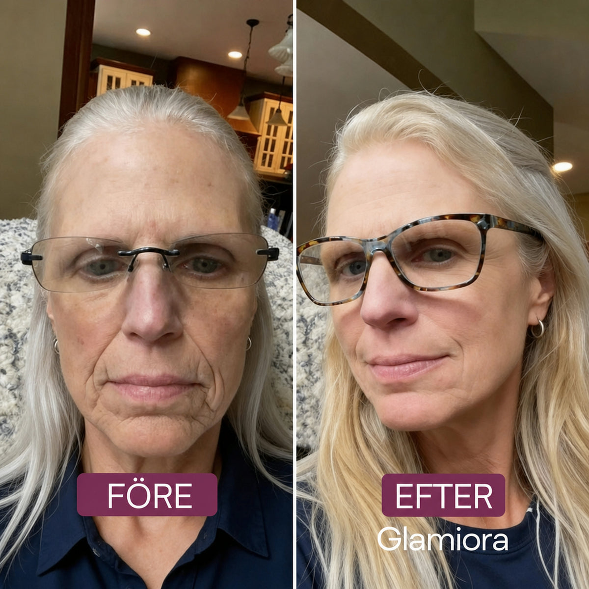 Anti-aging-set