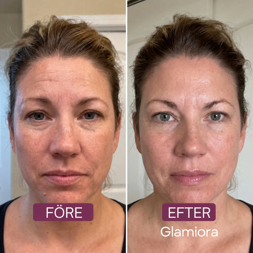 Anti-aging-set