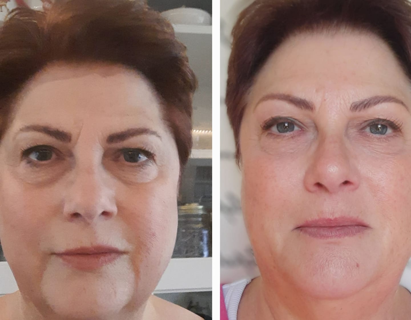 Kundfoto i recension av Bio-kollagenmask + borste