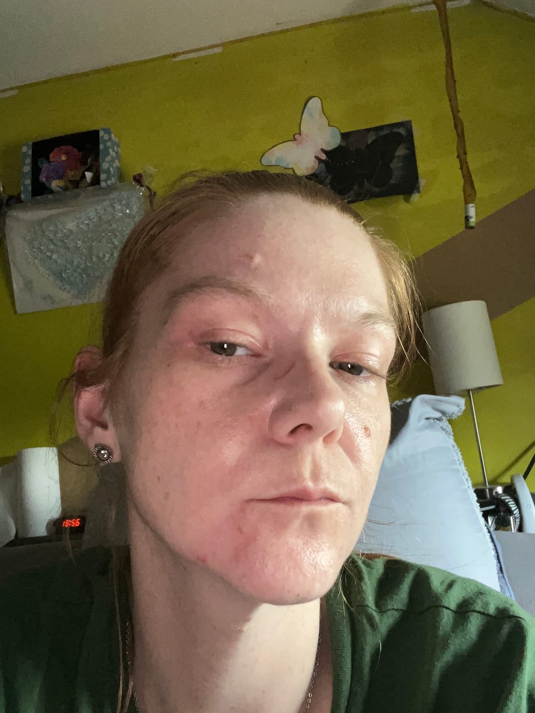 Kundfoto i recension av Bio-kollagenmask + borste